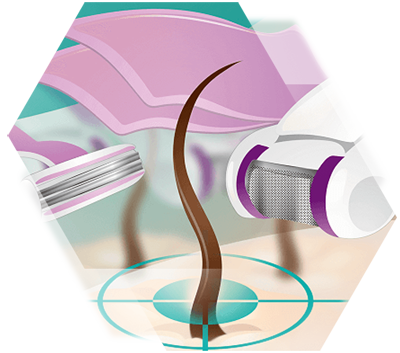 Illustration Razor and Epilation devices