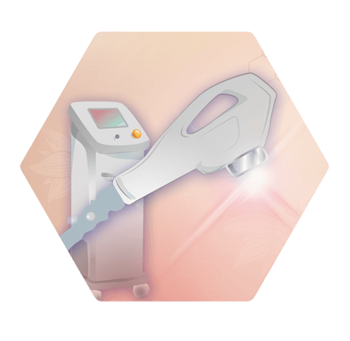 Permanent hair removal - IPL laser hair removal
