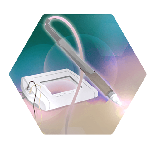 Illustration needle epilation device and handle