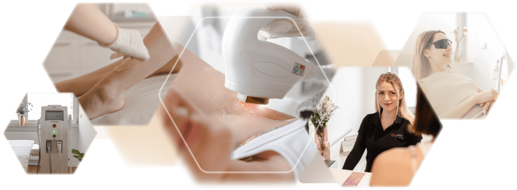 Fotos Behandlungskollage Photoepilation für die dauerhafte Haarentfernung für Frauen