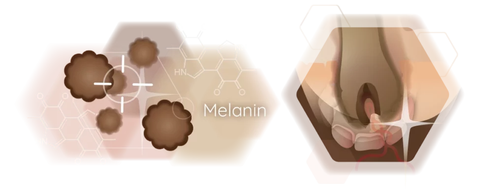 infographic melanin nested hair cells