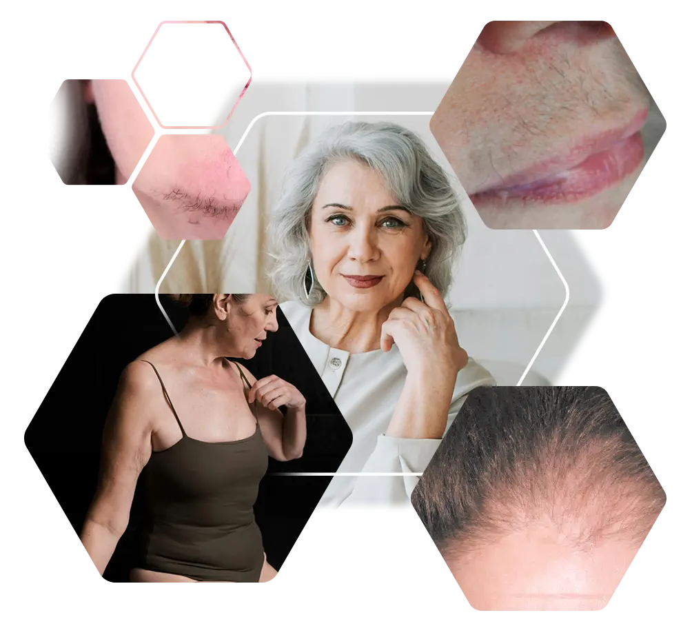 Best-Ager Haarprobleme bei älteren Frauen